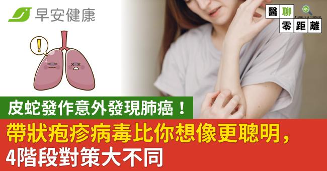 改寫標題：皮蛇發作揭露肺癌潛藏危機！帶狀皰疹病毒的聰明之處，四階段應對策略大不同